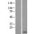 Western Blot: S100A5 Lysate [NBL1-15657] - Western Blot experiments. 
Left-Control; Right -Over-expression Lysate for S100A5